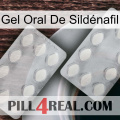 Gel Oral De Sildénafil 17